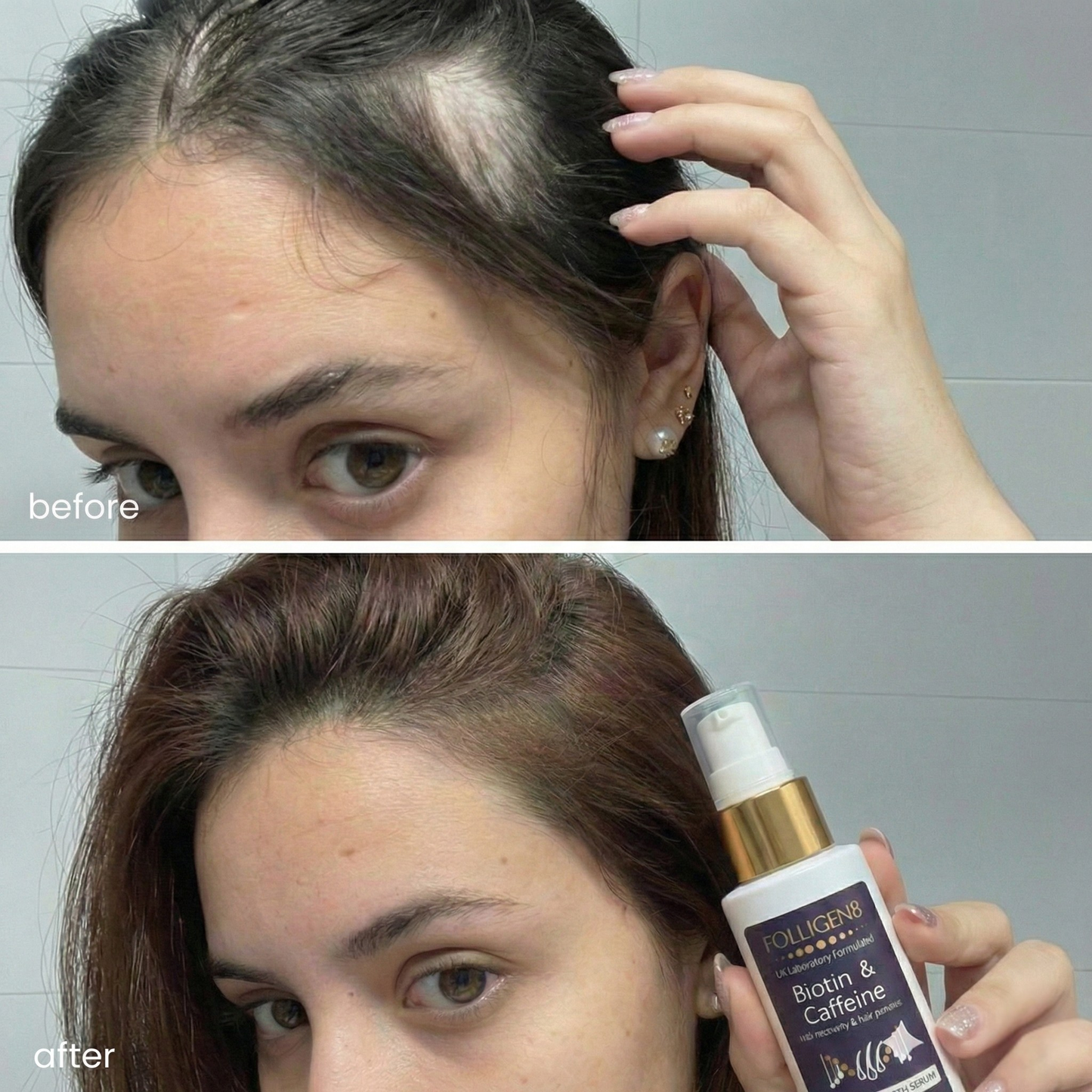 Folligen8™ Hair Regrowth Serum(60ml)